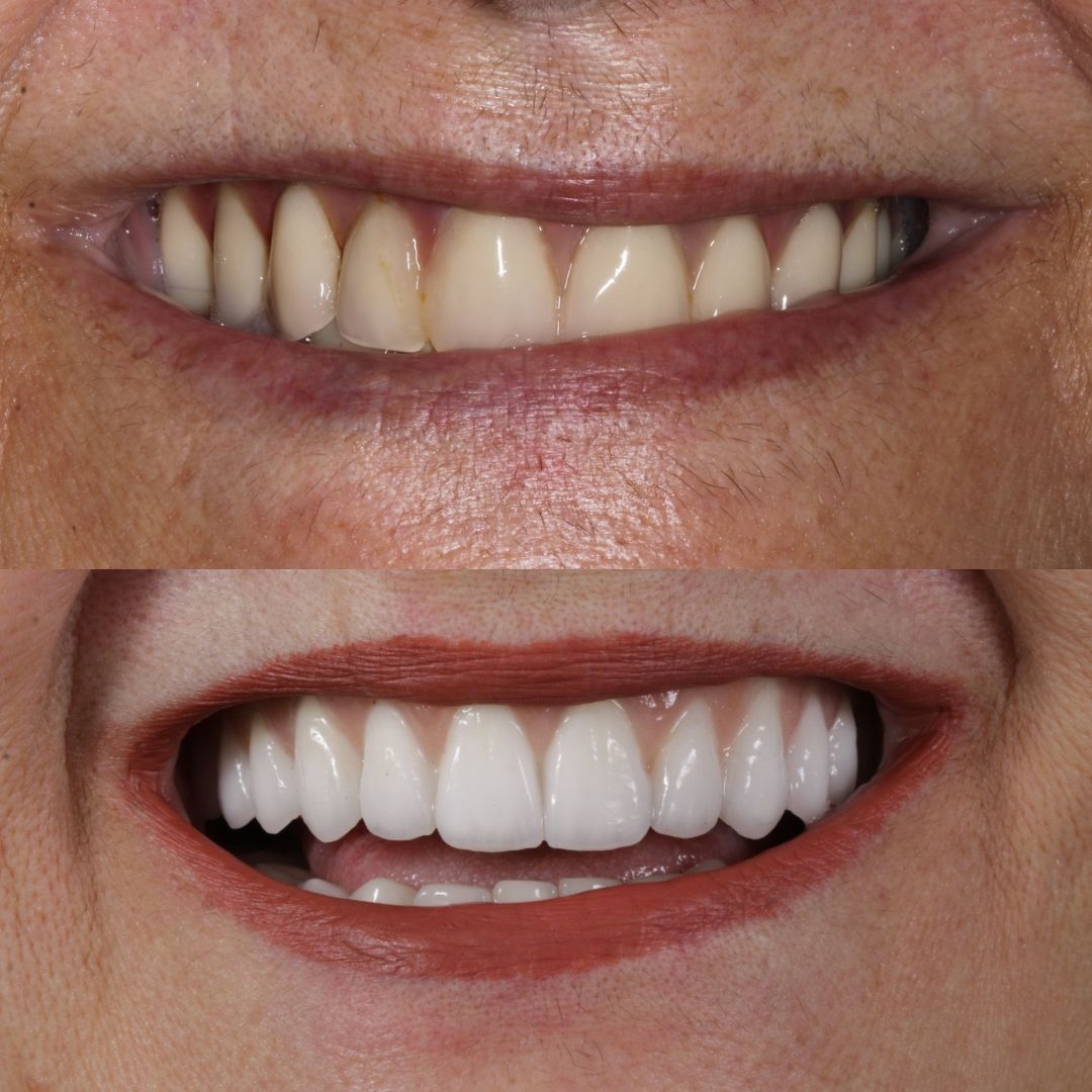 WhatsApp Image 2025-02-19 at 12.02.21 (1)